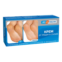 ДО И ПОСЛЕ крем для рук гидроактив 100мл